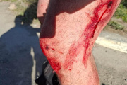 Fue a vender su auto y terminó con balazos en sus piernas