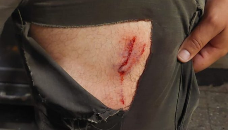 Dos perros sueltos mordieron a un guardaparque y se reaviva el debate por el ingreso de animales a las áreas protegidas