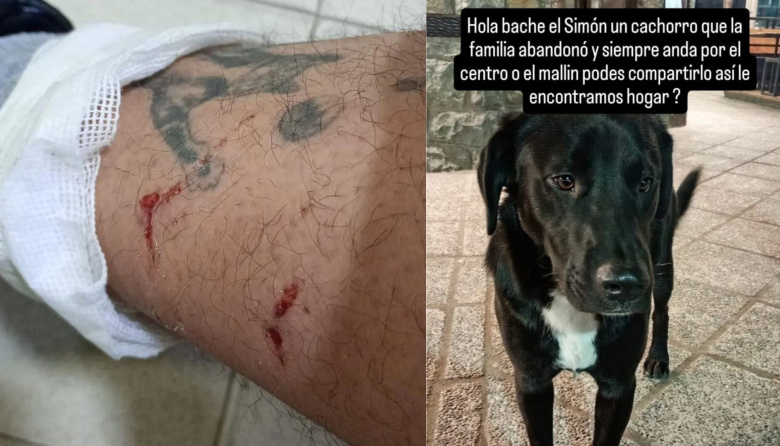 Un perro suelto siembra el miedo en pleno centro: ataques en serie, denuncias y una respuesta oficial que nunca llega