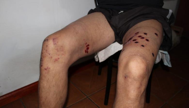 La policía rompió el portón, lo detuvo, le fracturo el brazo, y ahora no puede explicar por qué