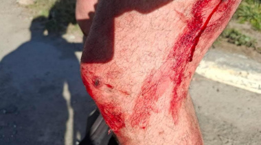 Fue a vender su auto y terminó con balazos en sus piernas