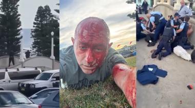 "Estuvimos un rato antes que empiecen los disparos": el testimonio de una barilochense sobre el ataque antisemita en Bondi Beach