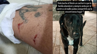 Un perro suelto siembra el miedo en pleno centro: ataques en serie, denuncias y una respuesta oficial que nunca llega