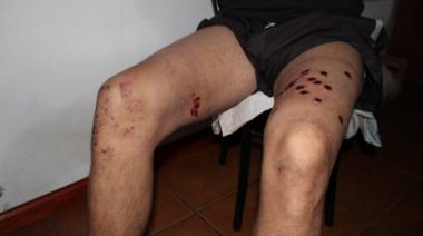 La policía rompió el portón, lo detuvo, le fracturo el brazo, y ahora no puede explicar por qué