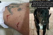 Un perro suelto siembra el miedo en pleno centro: ataques en serie, denuncias y una respuesta oficial que nunca llega