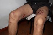 La policía rompió el portón, lo detuvo, le fracturo el brazo, y ahora no puede explicar por qué